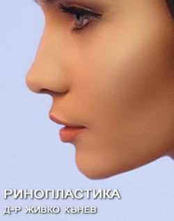 rinoplastica-dr-kanev.jpg